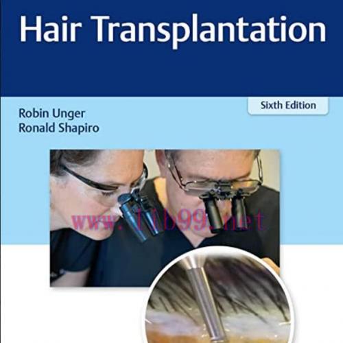 [PDF]Hair Transplantation 6th Edition [Robin Unger] PDF+online Videos