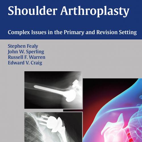 Thieme_ Shoulder Arthroplasty