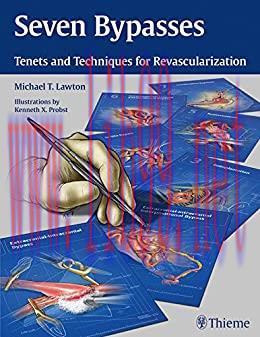 [AME]Seven Bypasses: Tenets and Techniques for Revascularization,1st edition (EPUB)