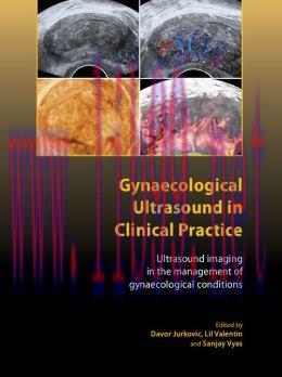 [AME]Gynaecological Ultrasound in Clinical Practice: Ultrasound Imaging in the Management of Gy...