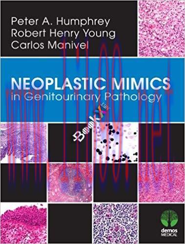 [PDF]Neoplastic Mimics in Genitourinary Pathology