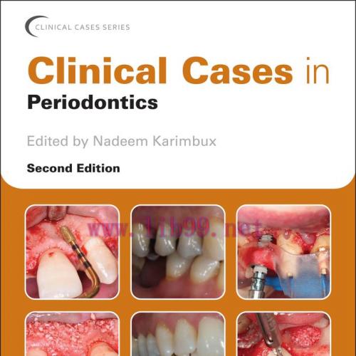 [AME]Clinical Cases in Periodontics, 2nd Edition (EPUB)