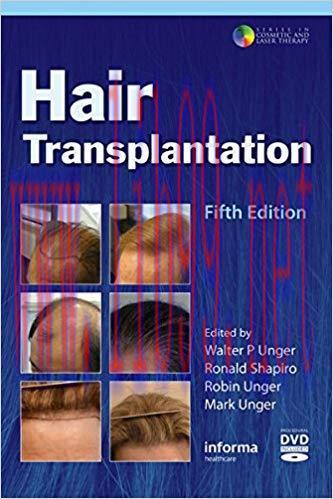 [PDF]Hair Transplantation 5th Edition