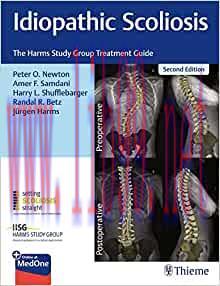 [AME]Idiopathic Scoliosis: The Harms Study Group Treatment Guide, 2nd Edition (EPUB)
