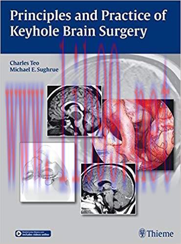 [PDF]Principles and Practice of Keyhole Brain Surgery + Videos