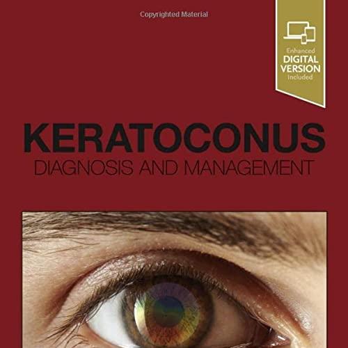 Keratoconus Diagnosis and Management 1st Edition