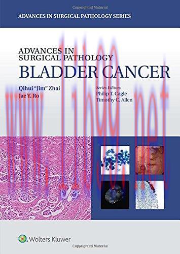 [AME]Advances in Surgical Pathology: Bladder Cancer (EPUB)