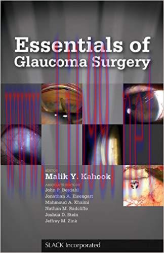 [PDF]Essentials of Glaucoma Surgery