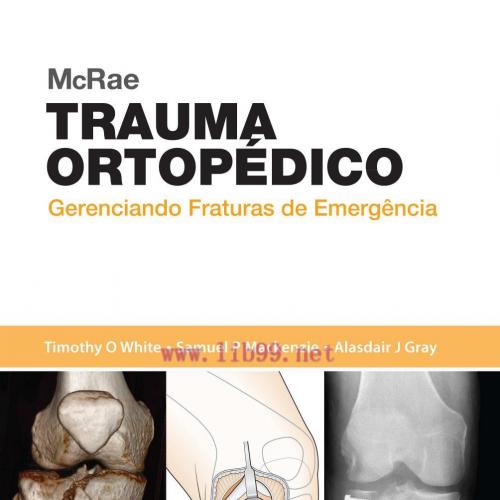 [AME]McRae Trauma Ortop&eacute;dico (Portuguese Brazilian) (PDF)