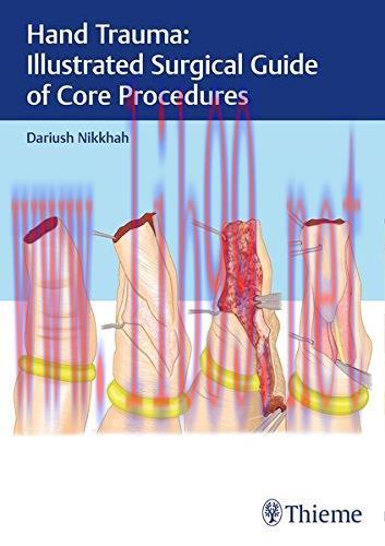 [AME]Hand Trauma: Illustrated Surgical Guide of Core Procedures (PDF)