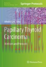 [PDF]Papillary Thyroid Carcinoma: Methods and Protocols