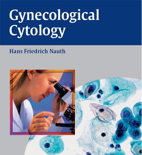 Gynecologic Cytology
