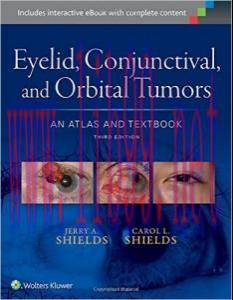 [AME]Eyelid, Conjunctival, and Orbital Tumors: An Atlas and Textbook, Third Edition (EPUB)
