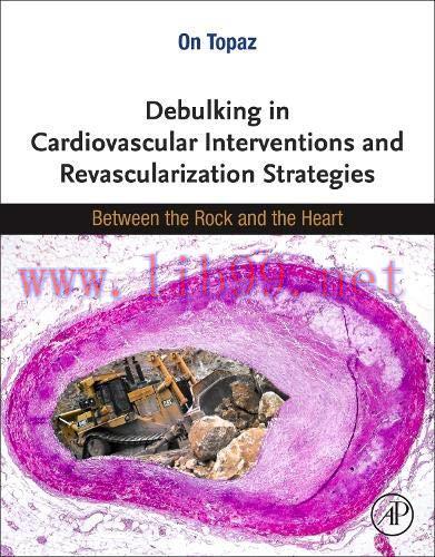 [AME]Debulking in Cardiovascular Interventions and Revascularization Strategies: Between a Rock...