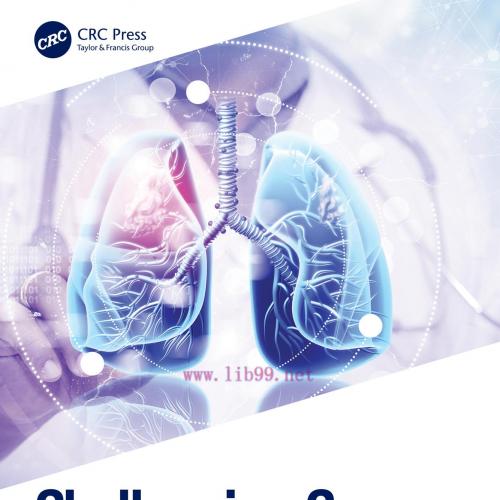 [AME]Challenging Cases in Pleural Diseases (EPUB)
