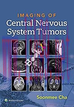 [PDF]Imaging of Central Nervous System Tumors