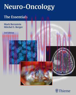 [AME]Neuro-Oncology: The Essentials, 3rd Edition (ORIGINAL PDF from_ Publisher)