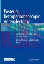 [PDF]Posterior Retroperitoneoscopic Adrenalectomy: Indications, Technical Steps and Outcomes