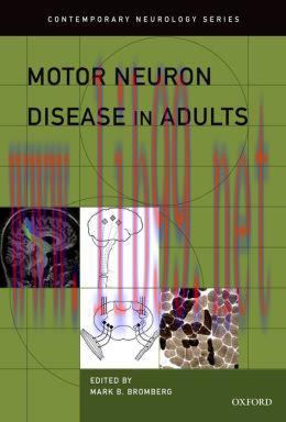 [AME]Motor Neuron Disease in Adults