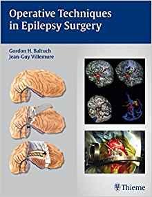 Operative Techniques in Epilepsy Surgery