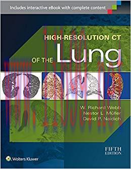 (PDF)High-Resolution CT of the Lung 5th Edition