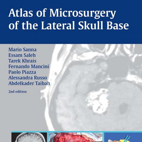 Atlas of Microsurgery of the Lateral Skull Base