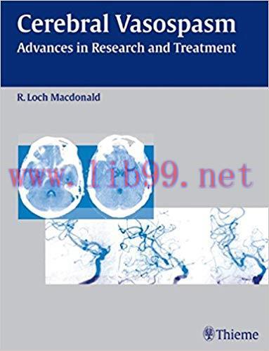 [PDF]Cerebra Vasospasm - Advances in Research and Treatment